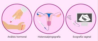es posible quedar embarazada despues de una histerosalpingografia