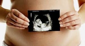 puedo quedar embarazada despues de una cesarea